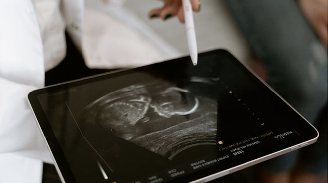 An ultrasound image of a fetus displays on a tablet.