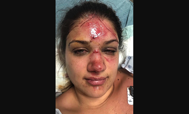 Texas Woman Says She Was Attacked While Tubing in New Braunfels