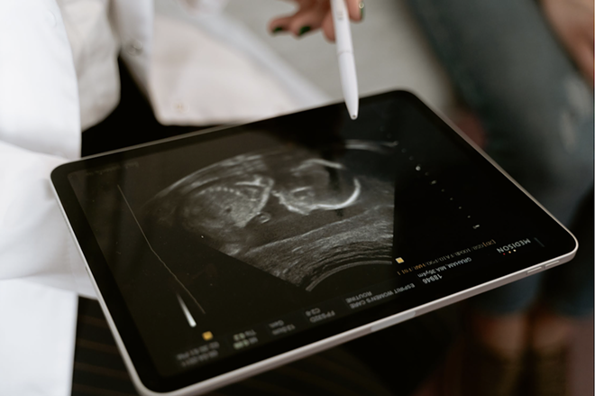 An ultrasound image of a fetus displays on a tablet. - Pexels / MART PRODUCTION