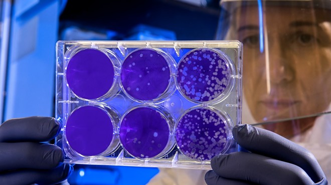 A scientist examines the result of a plaque assay, which is a test that allows scientists to count how many flu virus particles are in a mixture.
